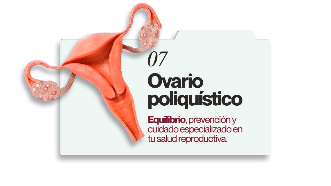 Ovario poliquístico