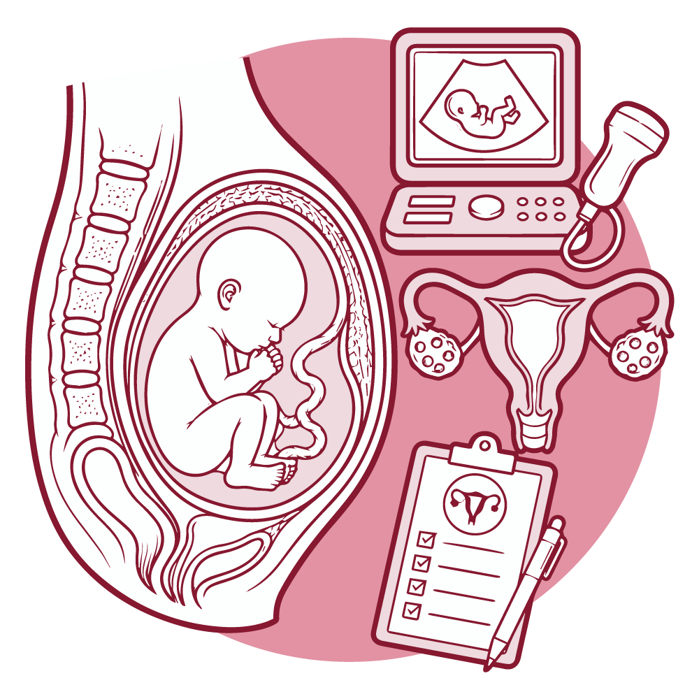 Ilustración de ginecología y obstetricia